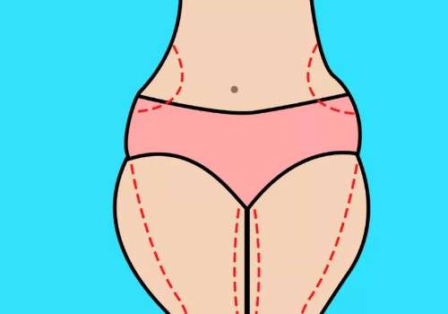 成都蒲小兵是一直在军大整形执业吗？是的，擅长吸脂/填充_口碑高！插图4