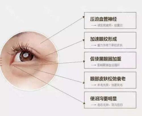 九院刘莺割眼袋怎么样？内切去眼袋3-7天消肿，价格6000元不等插图