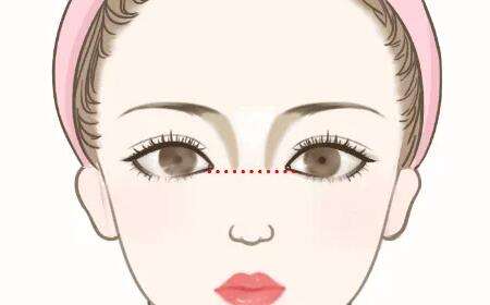 熊飞医生口碑怎么样？鼻部整形医生推荐 | 雅丽达插图2