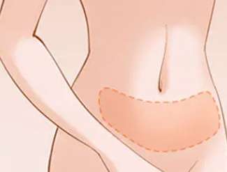 王汉峰医生怎么样？脂肪整形医生推荐 | 西安国际医学中心医院整形插图4