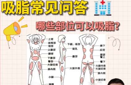 杨德发医生怎么样？吸脂 | 广东韩妃插图3