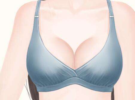 颜玲医生口碑怎么样？胸部整形医生推荐 | 可玉整形插图2