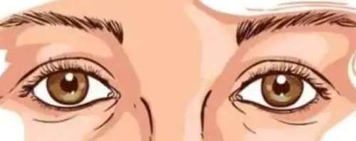 安医大二附院整形科哪个双眼皮开得好？曹东升vs陈增宏等医生实力不容小觑！插图3