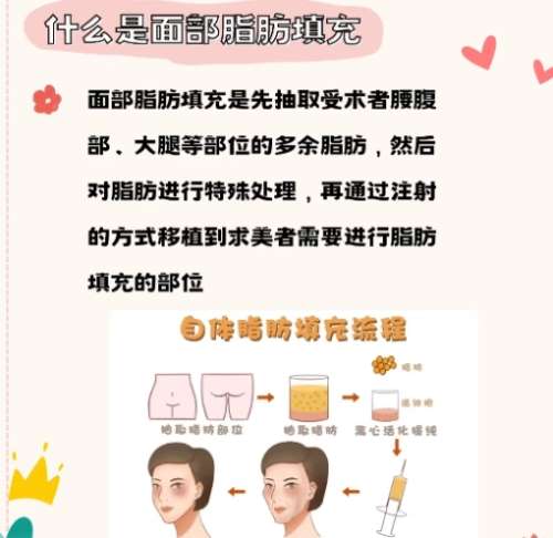 孙延辉医生怎么样?广州美莱医疗美容脂肪整形插图1 孙延辉医生怎么样?广州美莱医疗美容脂肪整形插图1