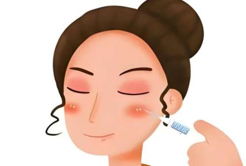 南京张荣明脂肪填充案例参考，技术经验积累多，价格合理口碑好插图