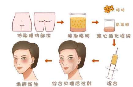 班永浩医生怎么样-脂肪整形-广运医疗美容插图1