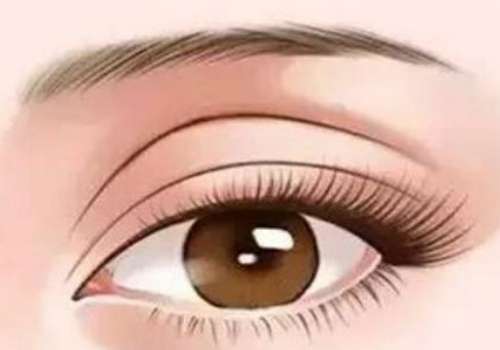 徐海艇双眼皮真的好吗？真实测评：确实不错，医生技术很稳，看实例插图1