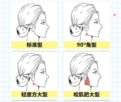 李勇辉医生口碑怎么样？下颌角整形医生推荐 | 广西爱思特整形外科医院插图1