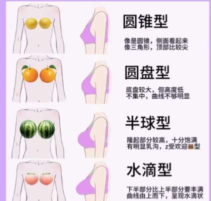 上海第一人民医院张兆锋医生怎么样？做隆胸技术如何？真人案例展示插图4