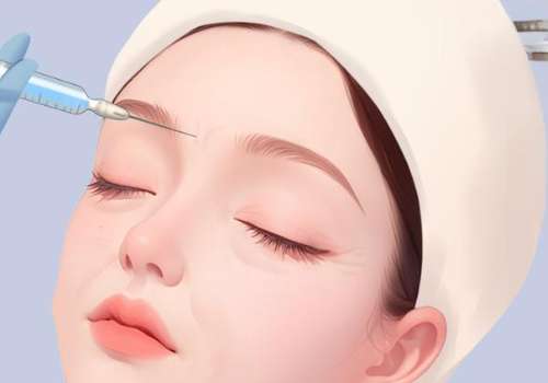 上海九院孙晓明怎么挂号？面部年轻化预约指南、附详细案例！插图3