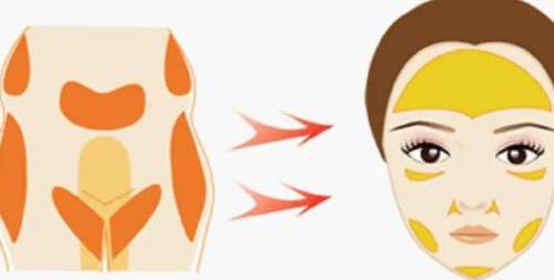 周壮医生怎么样-脂肪整形-华美整形外科医院插图2