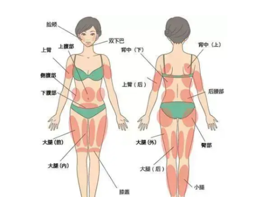 贵阳吸脂专家有哪些！医生排班表、挂号渠道及面诊费用全解析插图