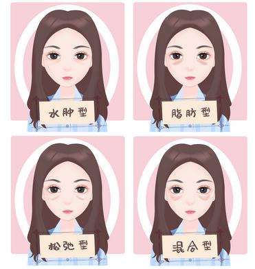 上海崔海燕光纤祛眼袋怎么样？同济医院整形外科主任技术实力详解！插图