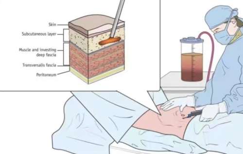 汤晓毅医生怎么样？脂肪整形医生推荐 | 深圳妍熙妍医疗美容插图1