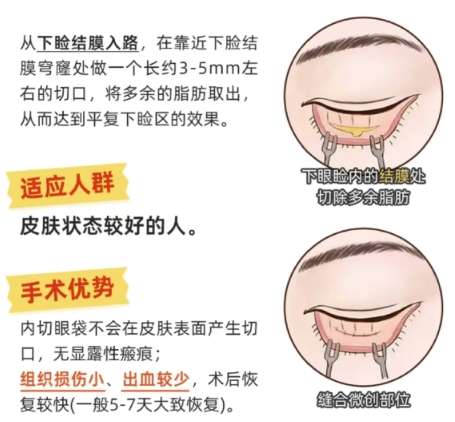 呙长模医生口碑怎么样？胸部整形医生推荐 | 徐州华美插图2
