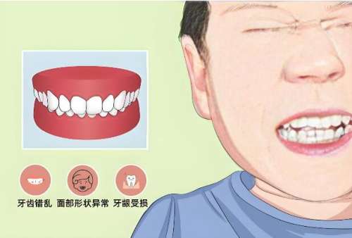 上海九院正颌正畸张雷，专科优势大揭秘插图1