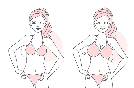 上海九院余力医生乳房整形案例分享！医生技术及术后效果解析插图2