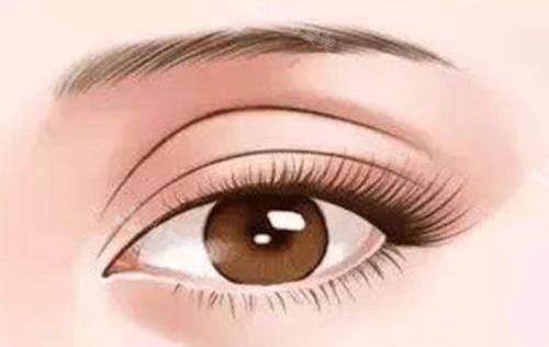 吴毅平做眼睛好不好？双眼皮、开眼角真实变化效果，看完再决定要不要做插图