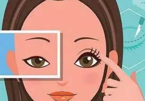 沈阳四院付荣嵘怎么样？眼整形医生，医生简介|案例|口碑等重点分享插图3