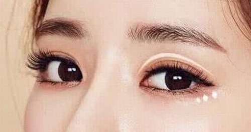 李民臣双眼皮做得好吗？做得不错，附医生资料+坐诊机构展示插图3