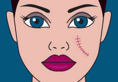 贵州人民医院杜娇怎么样？技术精湛，经验丰富！附价格表插图3