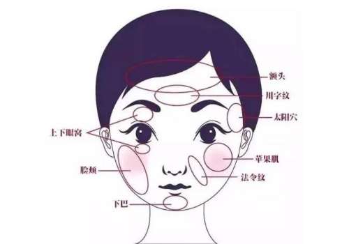 成都宋华敬和李烈面部脂肪填充好吗？2026技术比拼、审美口碑深度解析！插图