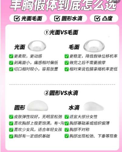 张晓圣医生 | 胸部整形医生推荐 | 北京皓尔国际医疗美容插图1