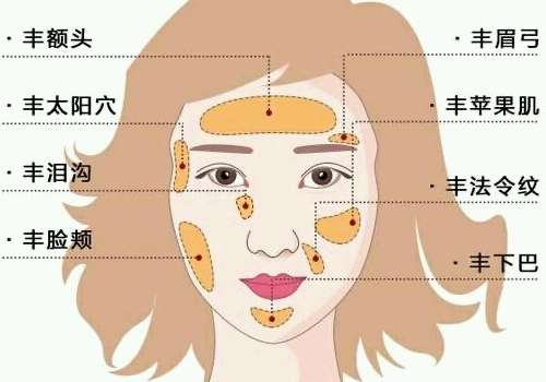 广州面部脂肪填充姜平案例公布！价格表+医生简介一览插图2