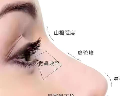 熊飞医生口碑怎么样？鼻部整形医生推荐 | 雅丽达插图1