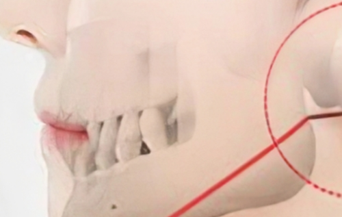 华西正颌医生有谁？能做正颌的专家名单和擅长方向都帮你整理好了插图