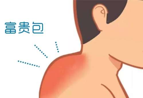 成都军大做富贵包如何？富贵包案例分享插图3