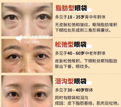 李勇医生怎么样?北京华韩脂肪整形插图3 李勇医生怎么样?北京华韩脂肪整形插图3
