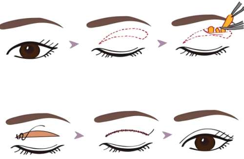 李德庆医生口碑怎么样？胸部整形医生推荐 | 武汉韩辰整形医院插图2