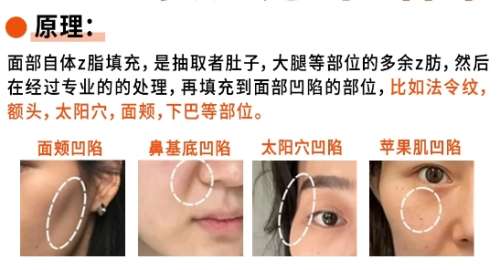 沈开生医生怎么样?医莱新美思医疗美容脂肪整形插图2 沈开生医生怎么样?医莱新美思医疗美容脂肪整形插图2