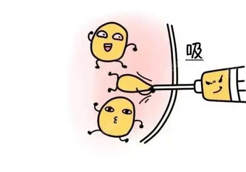 广州吸脂医生李奇军怎么样？口碑反馈+价格表插图1