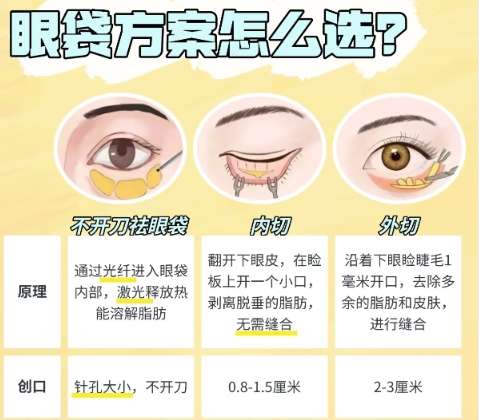 郭时伟的外切眼袋案例图展示！医生经验丰富、风格自然！插图3