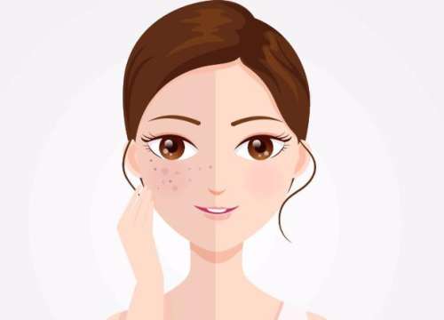 上海九院杨雅骊医生激光美容技术怎么样？患者评价汇总插图2