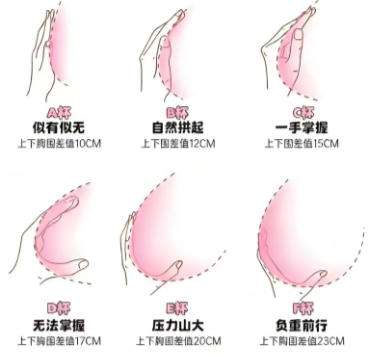 张宇医生怎么样-胸部整形-诗蔓整形插图3