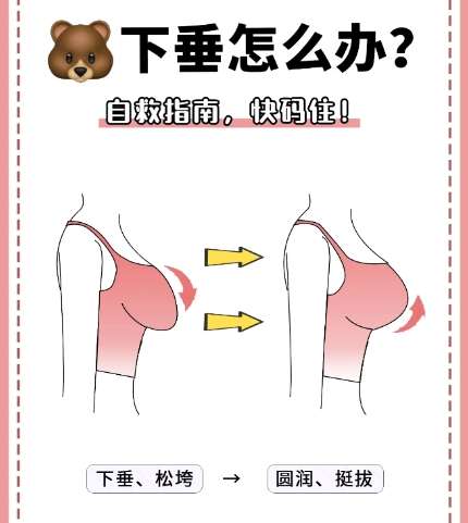 张晓圣医生 | 胸部整形医生推荐 | 北京皓尔国际医疗美容插图3