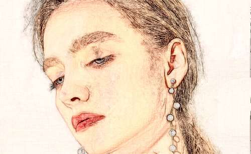 中日友好医院于瑞星v型脸整形120天术后恢复案例(效果怎么样?技术亮点)插图1