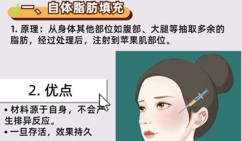 张旭光医生怎么样?黑龙江瑞丽脂肪整形插图4 张旭光医生怎么样?黑龙江瑞丽脂肪整形插图4