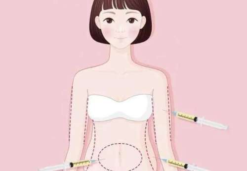 王汉峰医生怎么样？脂肪整形医生推荐 | 西安国际医学中心医院整形插图1