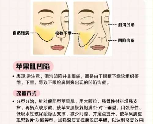 张旭光医生怎么样?黑龙江瑞丽脂肪整形插图3 张旭光医生怎么样?黑龙江瑞丽脂肪整形插图3
