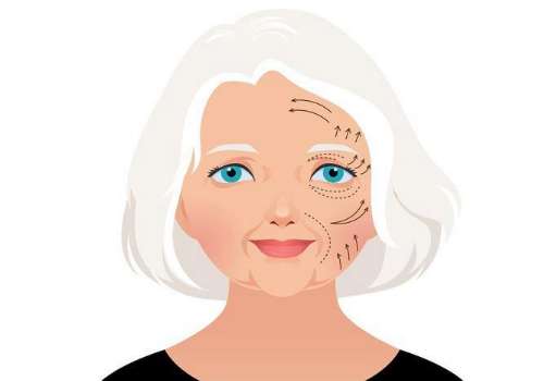 八大处王佳琦的拉皮案例分享！审美多元、操作娴熟、好评不断！插图2