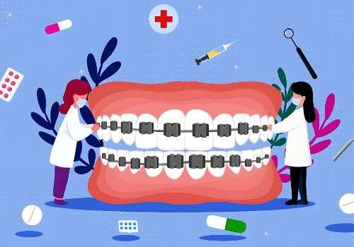 上海九院正畸夏韫晖好吗？医院技术很牛、反馈好插图1