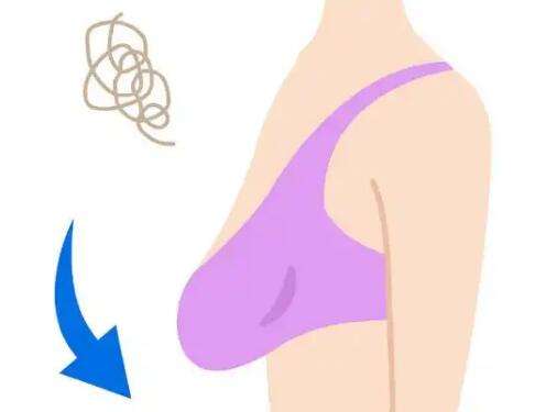 闫凯医生怎么样？胸部整形医生推荐 | 夏奈微尔插图3