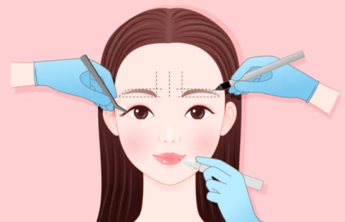 郝立君医生切眉手术如何？拆解郝立君切眉的设计思路、疤痕隐藏位置和适合人群插图