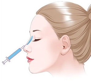 杭州梁敏雪医生擅长什么?眼鼻整形及面部年轻化项目一览插图2