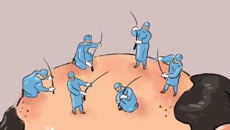 上海植发王志勇 · 医生简介、技术特点、收费价格参考插图1