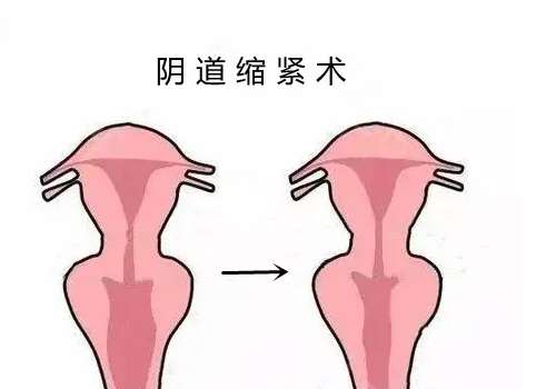 天津王爽医生擅长什么？女性私密整形技术好/经验丰富！插图4